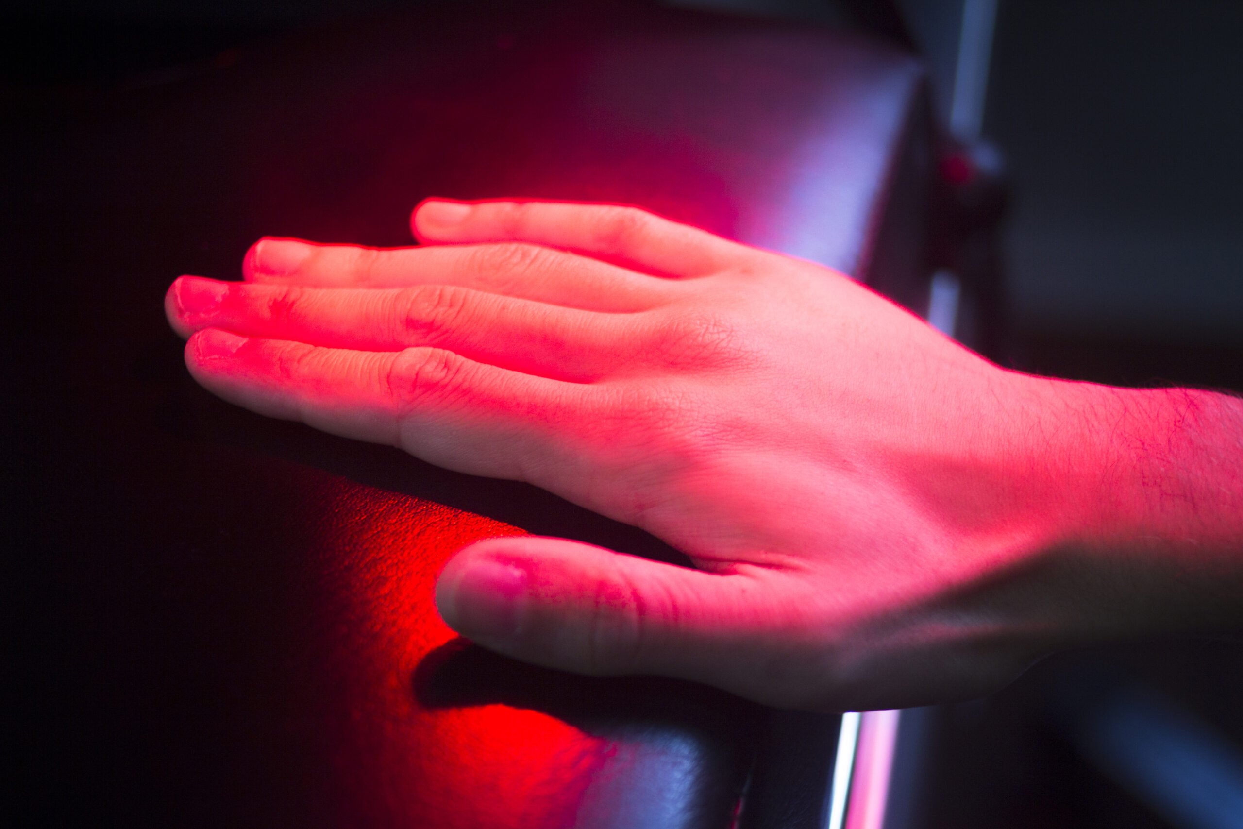 Patient Hand In Red Physiotherapy